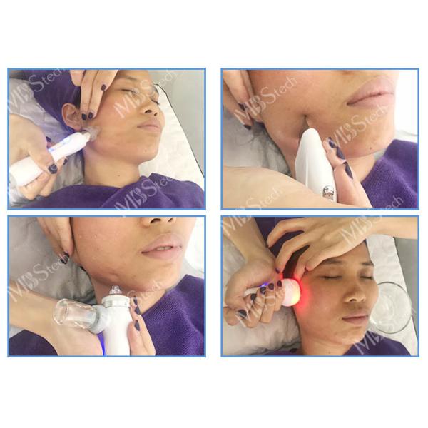 Глубокая очищая машина Microdermabrasion гидро воды лицевая