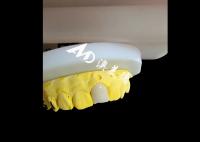 Coronas dentales de zirconia de aspecto natural y estético Restauración de dientes de ajuste perfecto