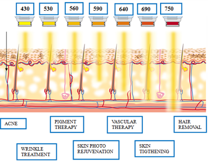 CE Approvaled E Light IPL Laser Hair Removal Machine Skin Care