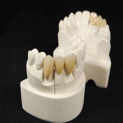 Co-Cr Crown Cobalt-Chromium Dental Crown with High Durability Biocompatible and Corrosion Resistant for Molars and Premolars