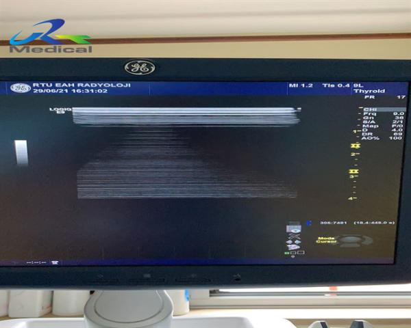5393908 5393912 Ultrasound Repair Service For GE Logiq E9 MRX Board Ultrasound Parts