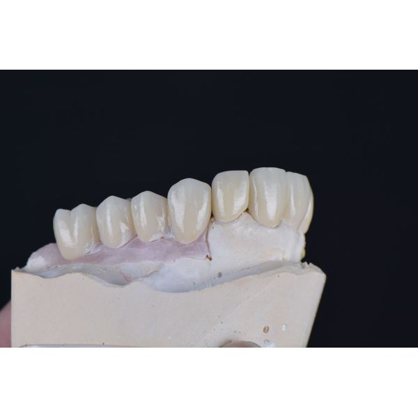 Bloque de zirconia multicapa Yucera 4D Plus de 95 mm, bloque de zirconio dental Yucera para laboratorio CAD/CAM