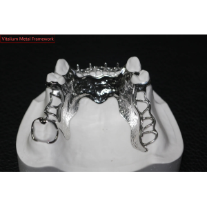 Titanium Alloy Metal Framework for Removable Dentures - Lightweight and High Corrosion Resistance