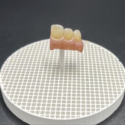 Mixable Shade System Paste Cervical / Incisal Zone Formulas For PFM & Glass Ceramic