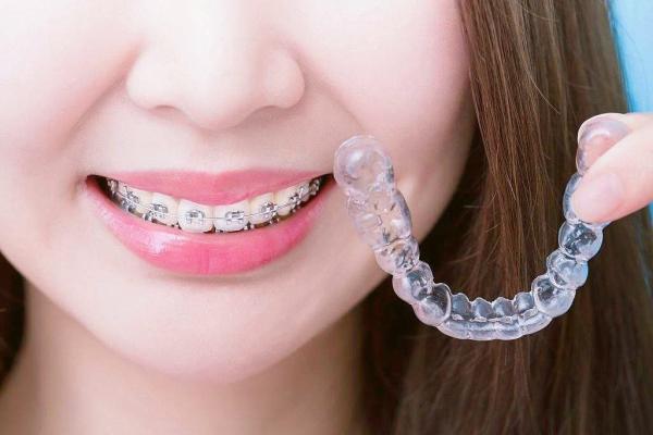 Advanced Technology And Stable Physical Properties Foil Roll For Making Aligners