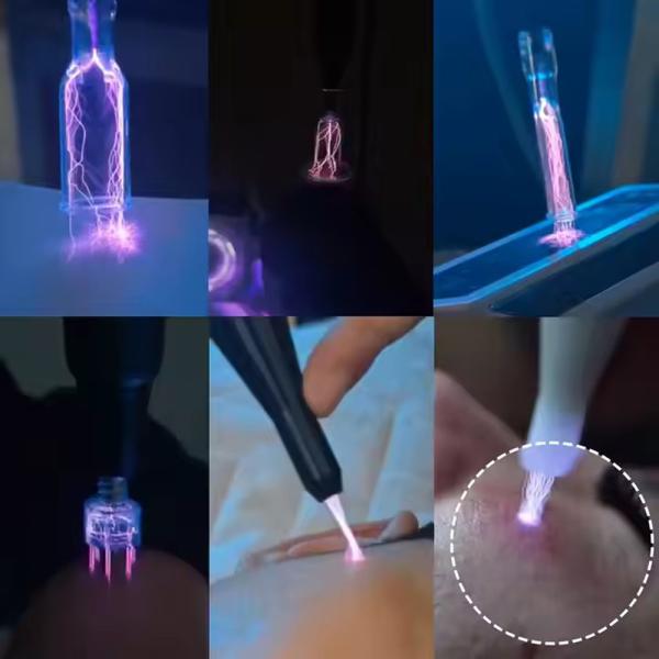 2025 Most Popular Newest Cool & Hot Plasma beauty instrument Technology Plasma Cold and Warm Hyper Cold Jet Scalp Diamond Stamp Jet Ozone-jet Plasma Machine.