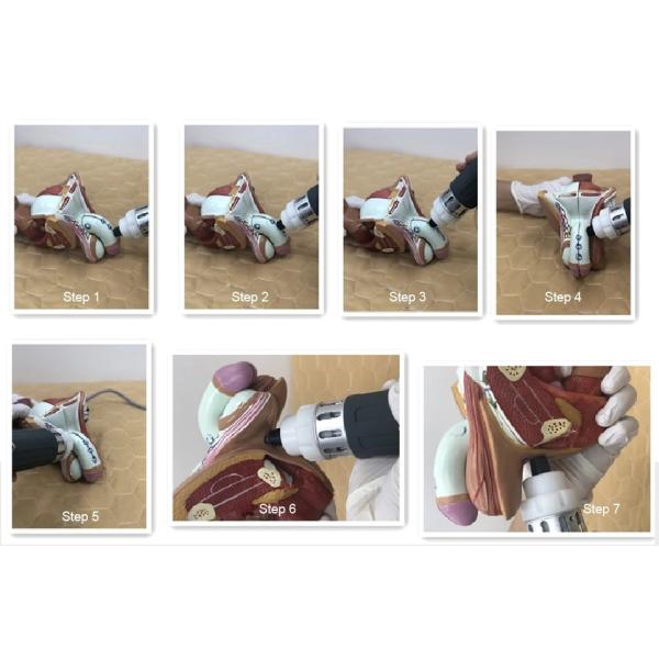 Pain Treatment Physical 80KPa Shockwave Therapy Equipment