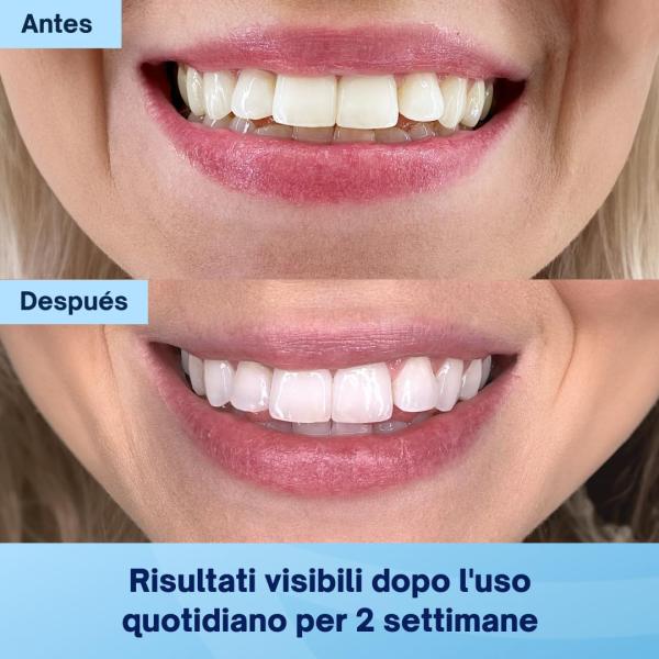 Cool Mint Flavour Teeth Whitening Powder Enamel Safe 6 Month Supply