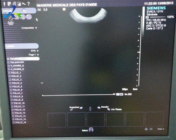 EV-8C4 Ultrasound Scanner Probe Endocavitary Healthcare Equipment