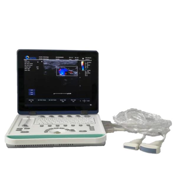 Hospital Outside 2D 3D Notebook Full Digital Color Doppler Ultrasound Diagnostic System Ultrasound Machine