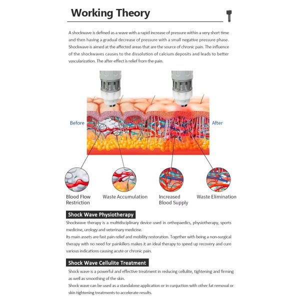 Focused Shock Wave Therapy Machine Physiotherapy Relief Rehabilitation Equipment