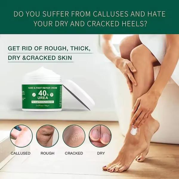 OEM Vitamina E Cuidados de mãos e pés Anti-seca Vaselina Ureia Creme Reparação de pés