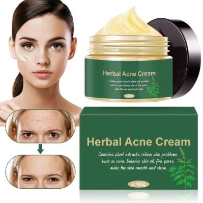 Organic Herbal Anti Acne Remover Pimple Treatment Repair Scar Cream