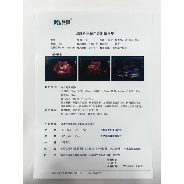 ユニバーサル 医療 PACS 医療機器のための超音波診断レポートフィルム