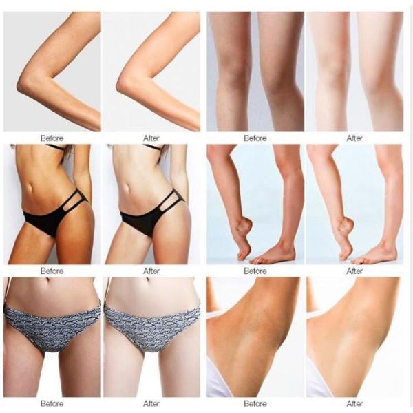 beauty armpit whitening cream for dark underarms