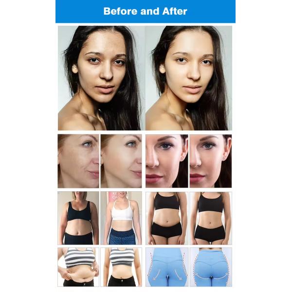 448K Body Care Therapy Equipment For Relaxing Muscle Pathology Arthritis
