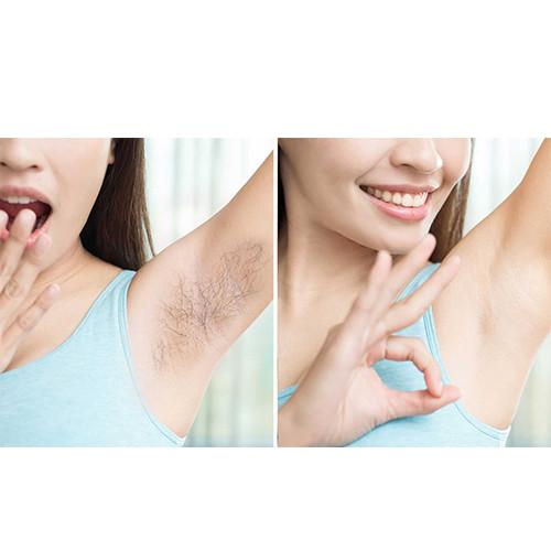 O dispositivo profissional IPL da remoção do cabelo do laser do titânio do gelo OPTA a máquina da remoção do cabelo do laser do diodo 808nm