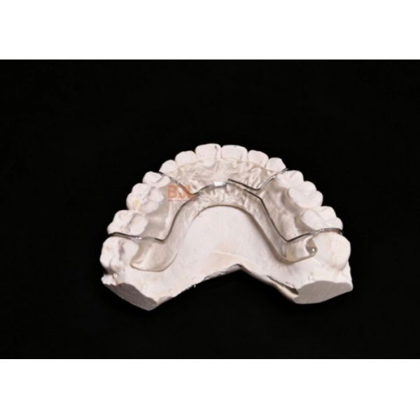 Customizable Dental Retention Device Offering Precise Fit and Enhanced Retention Capabilities for Post Orthodontic Care
