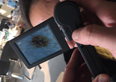 Verificador video da superfície da pele de USB do analisador da pele de Digitas do microscópio de Dermatoscope com o monitor de 3 polegadas