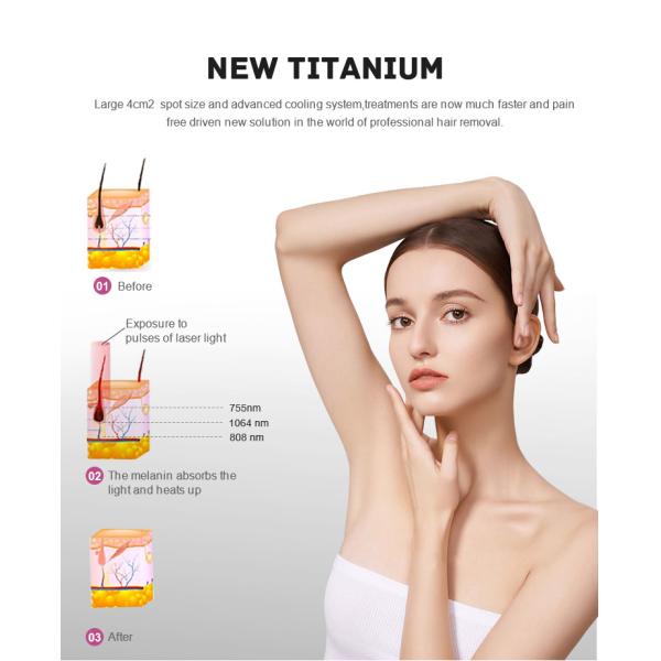 Профессиональная 808nm диодная лазерная эпиляция с технологией титанового лазера