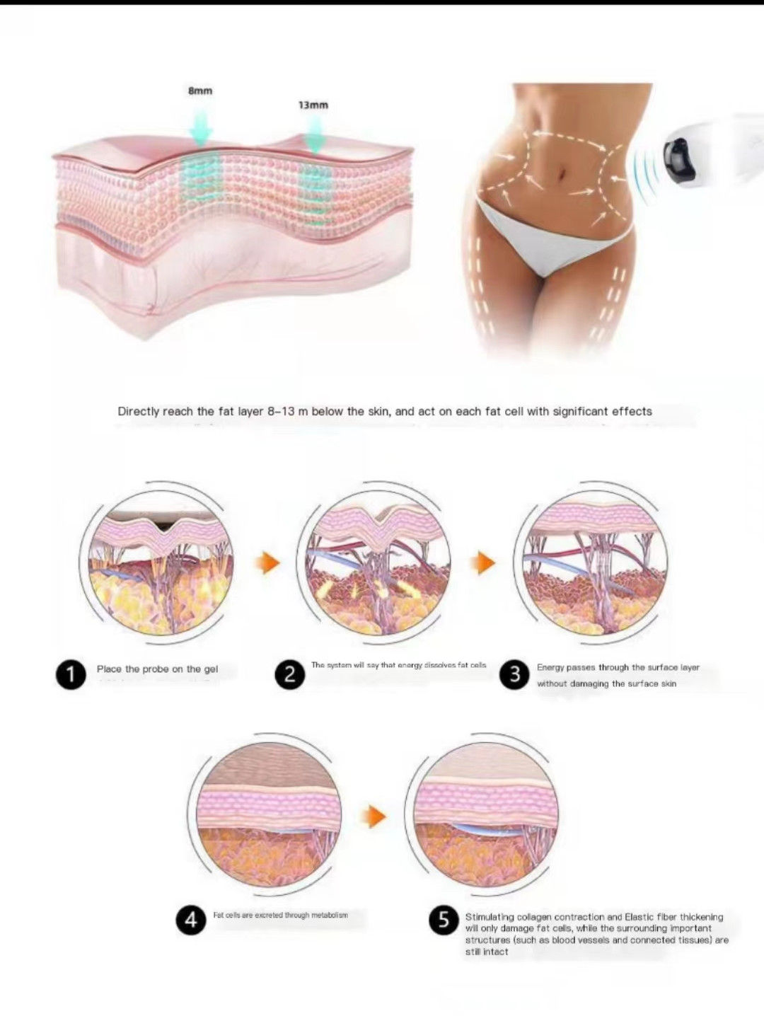 Уменьшение целлюлита машины 0.8cm 1.3cm красоты ультразвука HIFU Liposonic