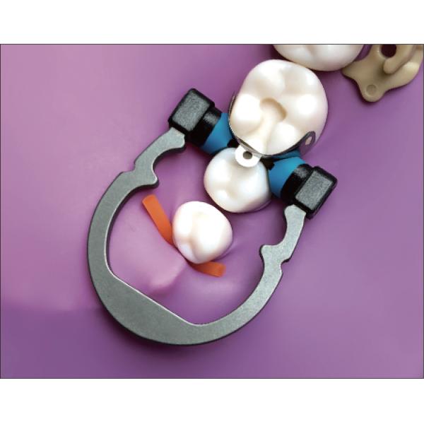 Triodent V3 Dental Sectional Matrix System Set Clamp Ring R5 1.0