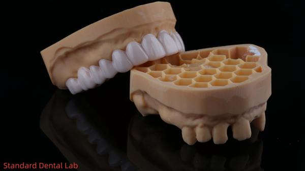 Appareils dentaires fonctionnels d' automne d' orthodontie du laboratoire dentaire chinois