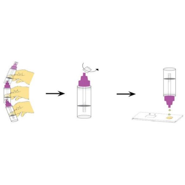 Аттестованный КЭ результат Мулти образца анализа крови вирусной инфекции ХАВ надежный реактивный
