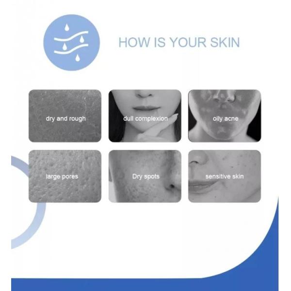 14 In 1 Peeling Hydro Microdermabrasion, Oxygen Jet Aqua Care, Deep Cleansing And Moisturizing Skin, Removes wrinkles