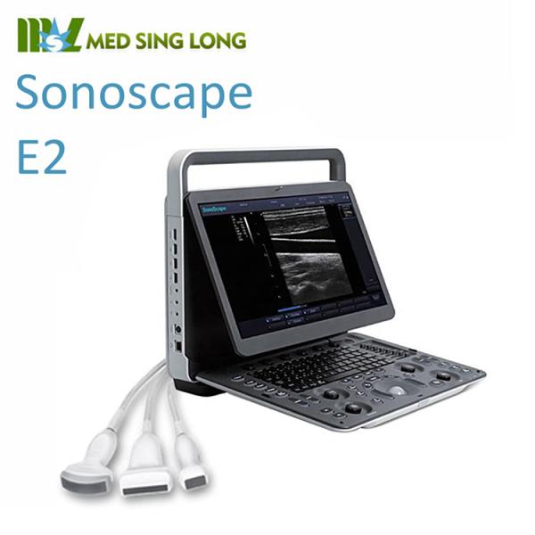 SonoScape E2pro Color Doppler Echo Machine Ultrasound Machine USG with TDI CW PW Function