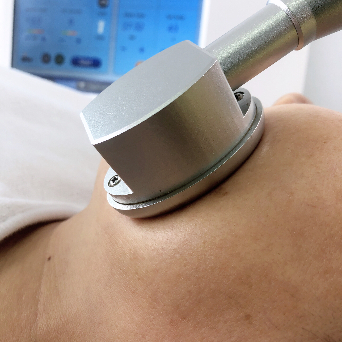 Кожа Resurfacing частичная машина RF Microneedle с холодной терапией инвазионной