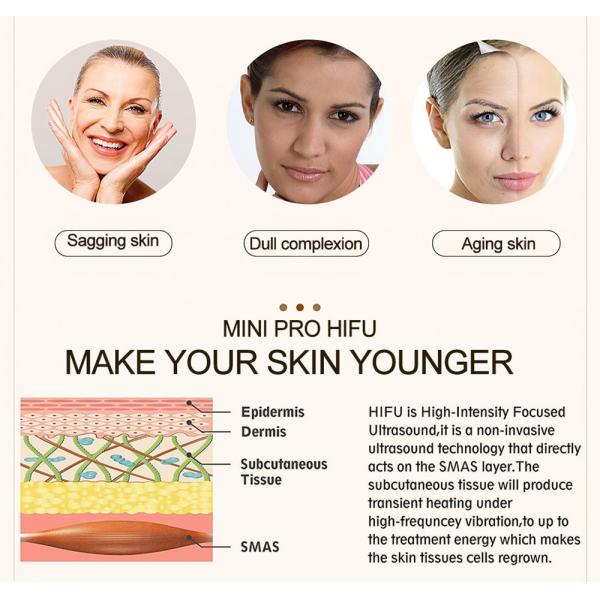 Оборудование красоты Rf для заботы кожи красоты домочадца стороны и аппаратуры красоты радиочастоты веснушки