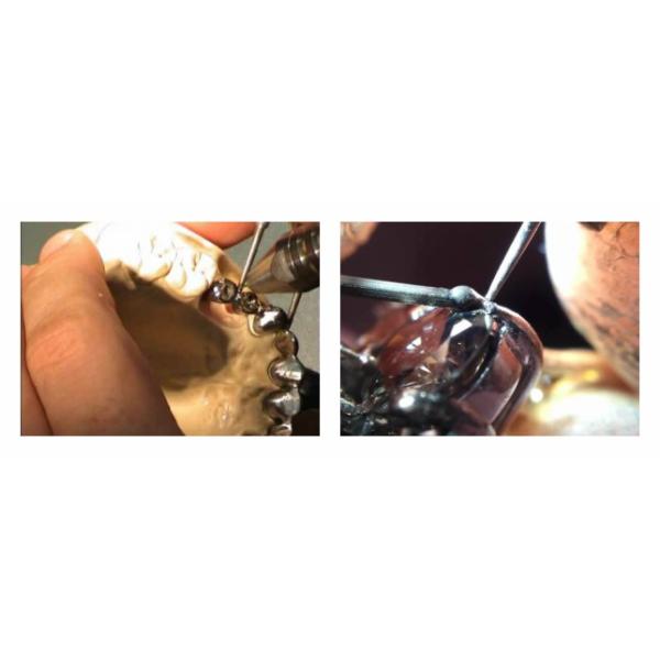 ND Yag Laser Welding Machine Pulse Spot Welding Machine Gold Dental Easy Use