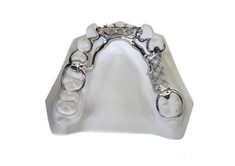 Easy To Clean Metal Frame Partial Denture Comfortable For Long Lasting Use