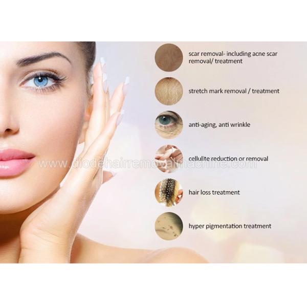 Commercial Micro Derma Pen Automatic Micro Needle Therapy System With Needle Cartridge