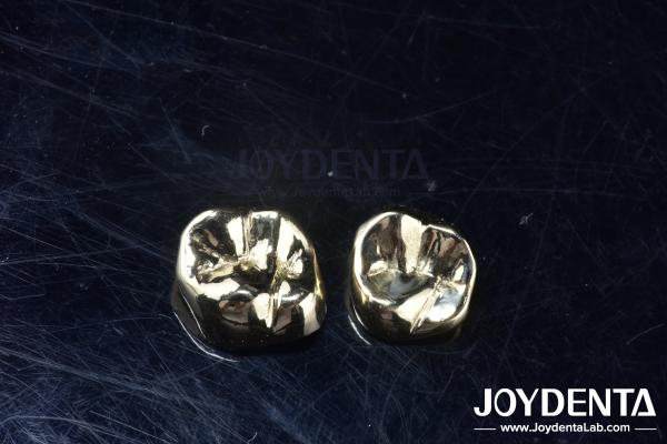 Wax Casting Dental Repair Full Metal Crown For Abrasion Resistant Oral Rehabilitation