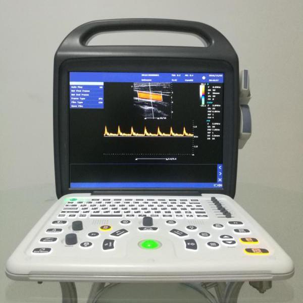 Best Price Portable Veterinary Ultrasound Scanner 2D/Doppler For Small & Large Animals
