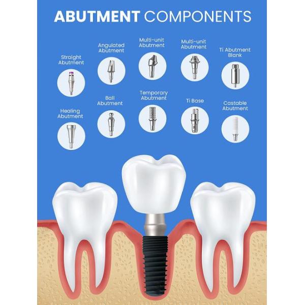 Dental Implant System Customized 2D/3D/Drawing Design and Healing Dental Abutment