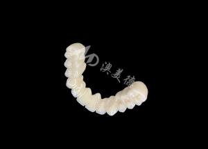 Long-lasting Bonding PFM Dental Crown Bridge With Excellent Biocompatibility