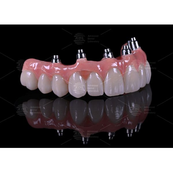China Dental Lab Titanium Screw Retained Malong Design A1 Shade Full Arch Hybrid Bridge