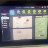 Máquina inteligente de clasificación de núcleos de nuez de varios grados 750 kg / hora de acero inoxidable