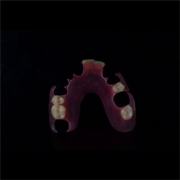 Comfortable Partial Valplast Flexible Dentures Nylon Material
