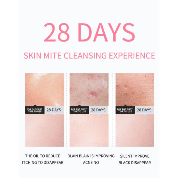 Мытье стороны перевозчика угорь Cleanser Skincare 120ml OEM пенясь лицевое