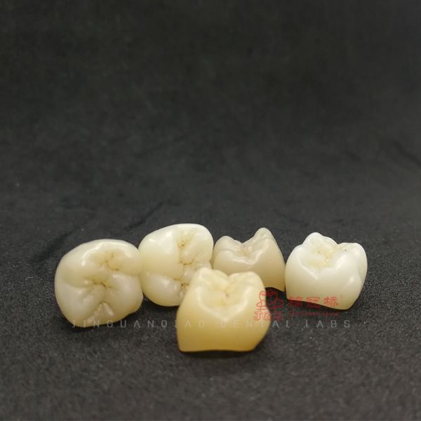 Denture False Teeth PFZ Crowns Bridges Chinese Dental Lab Customized