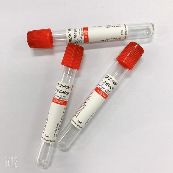 Do vácuo do sangue da coleção do tubo anticoagulação lisa consumível não