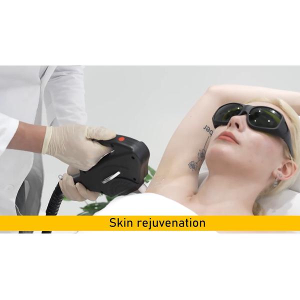 Épilation laser à diode portative 808nm Picosecond Machine d'épilation de tatouage