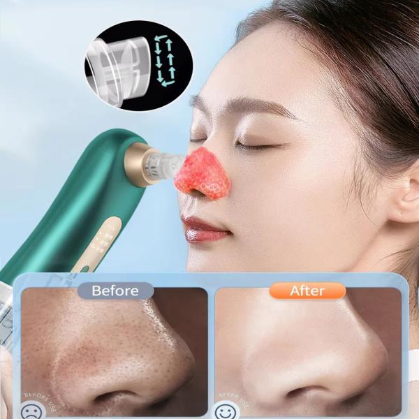 Rechargeable Acne Pore Suction Machine Electric Vacuum Suction Blackhead Remover