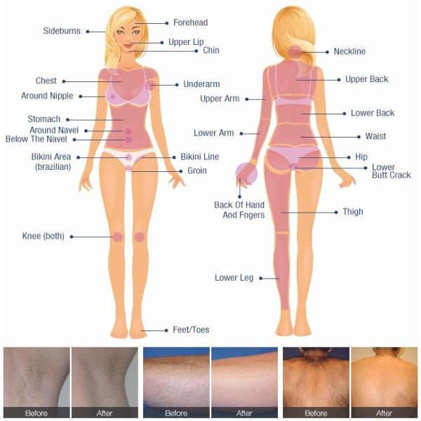 Машина удаления волос лазера диода 808 постоянная, машина депиляции лазера косметологии