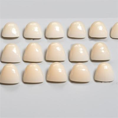 16 Shades Comfortable 0.3-0.5mm Thickness Feldspathic Dental Veneers for Cosmetic Dentistry