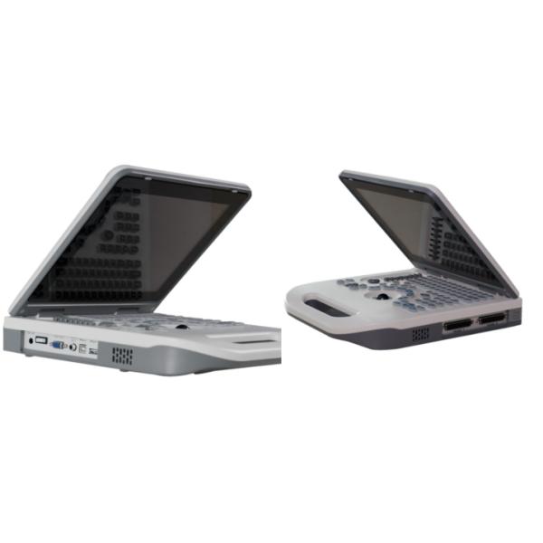 Оборудование LCD ультразвука OEM OB акушерское показывает управление TGC